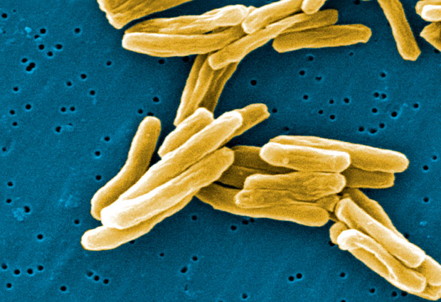 Tuberculosis remains a major global health concern: in 2013, an estimated 1.5 million people died from the disease. IMAGE: Janice Carr, Centers for Disease Control and Prevention